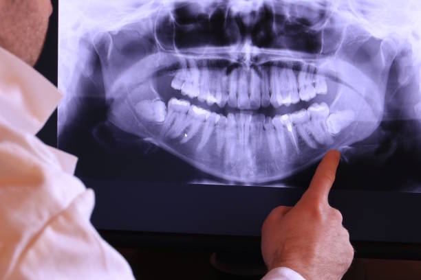 Best Chipped Tooth Repair Near Me  in Mastic, NY