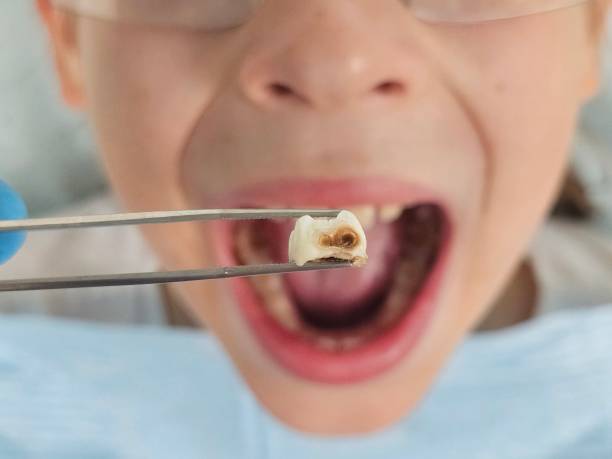 Best Chipped Tooth Repair Near Me  in Mastic, NY